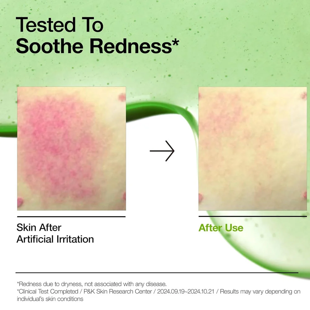 Anua Azelaic Acid 10 Hyaluron Redness Soothing Serum - Image 4